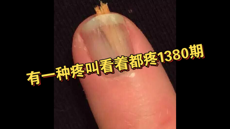 有一种疼叫看着都疼138...