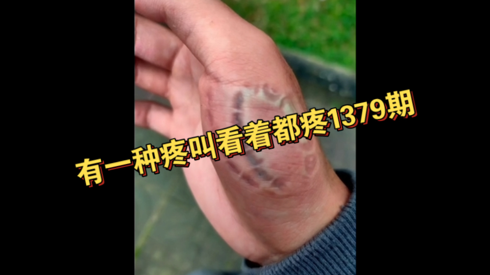 有一种疼叫看着都疼137...